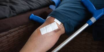Kreuzbandriss Reha in Zürich | Physiotherapie Waidfuss