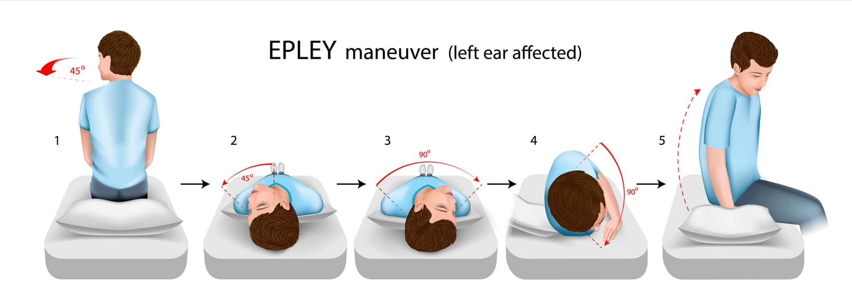 Epley maneuver: 5-step storage maneuver in storage dizziness (BPLS), left ear affected